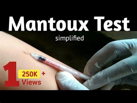 mt test positive images